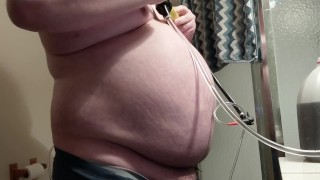 腹部充气,近 2 加仑水