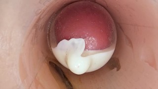 阴道深处的摄像头记录下大量精液射入避孕套的过程